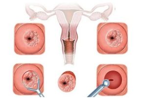 bệnh lây qua đường tình dục