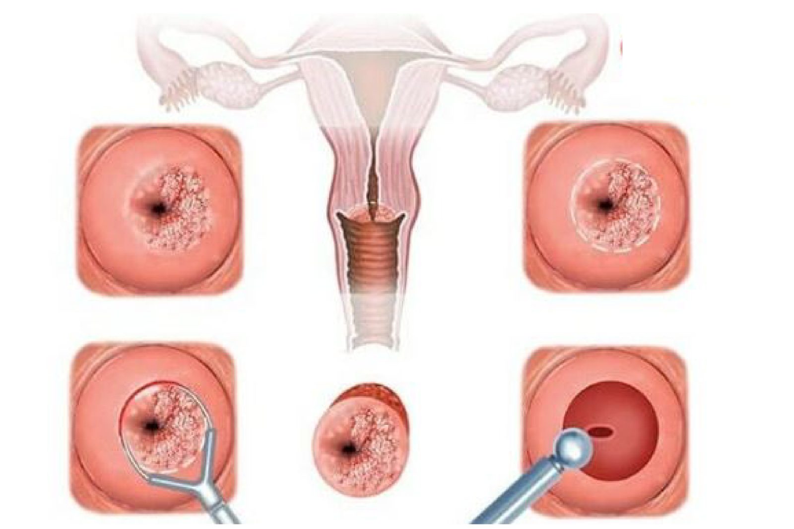 bệnh lây qua đường tình dục