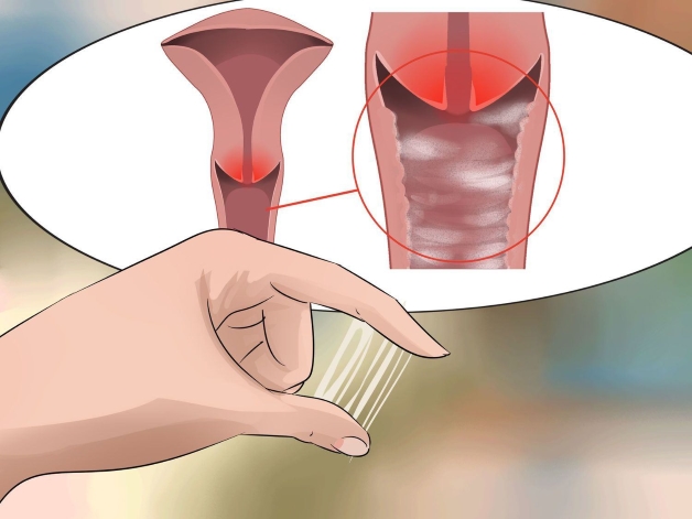 bệnh lây qua đường tình dục
